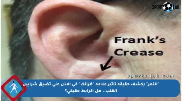 “النمر” يكشف حقيقة تأثير علامة “فرانك” في الأذن على تضيق شرايين القلب.. هل الرابط حقيقي؟